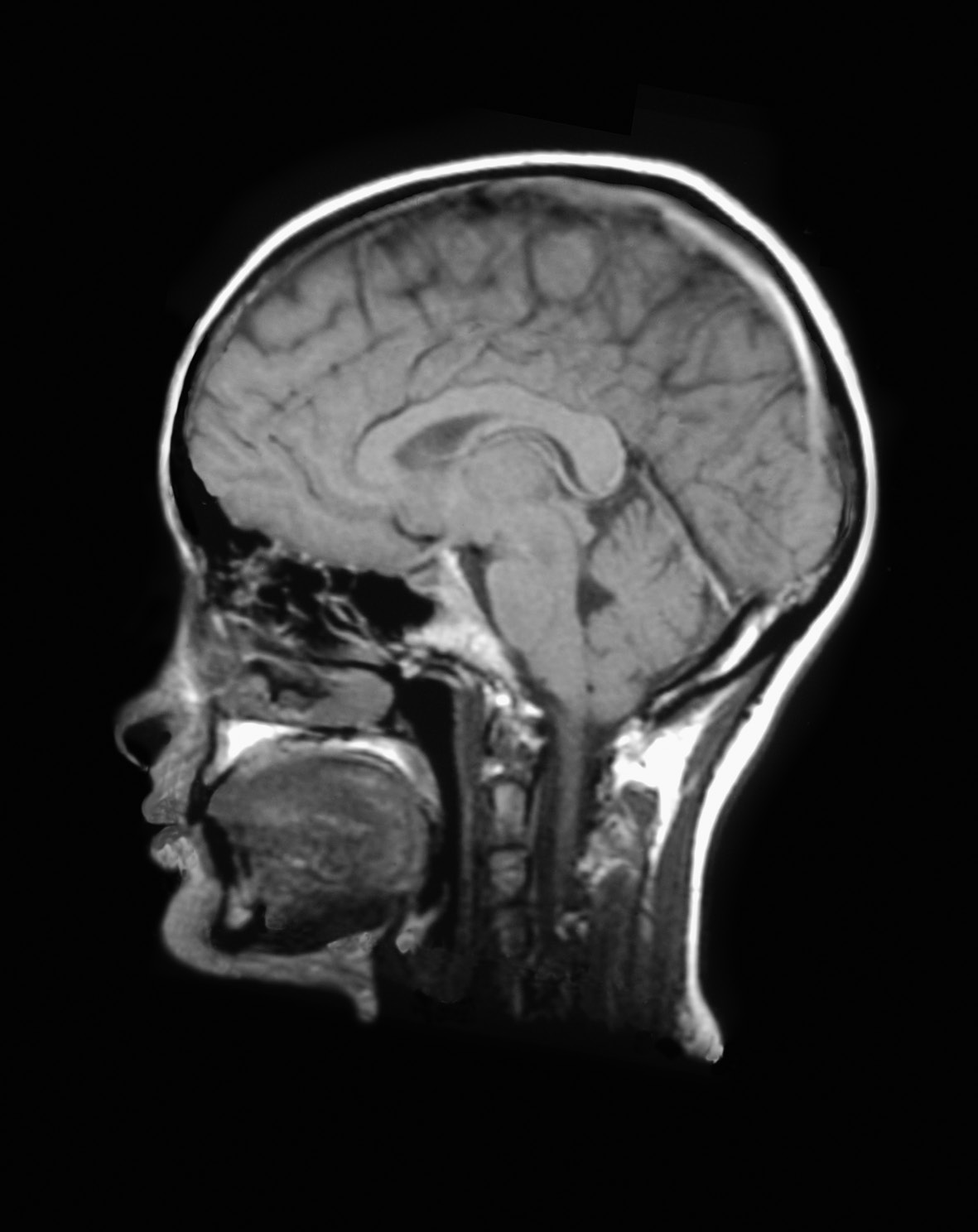 The Impact of BPA on Brain Health